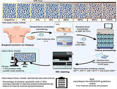 Clinical implication of low estrogen receptor (ER-low) expression in breast cancer